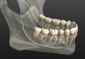 的確で詳細な治療計画