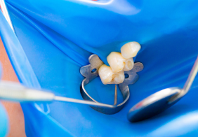 徹底した無菌環境の維持